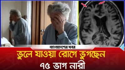 ভুলে যাওয়া রোগে ভুগছেন ৭৫ ভাগ নারী