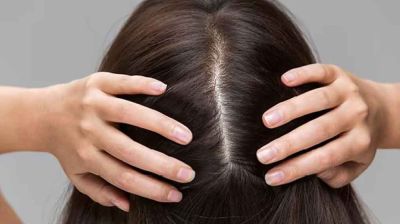 ঘামে ভিজে চুল পড়লে করণীয় কী