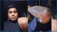 গাজীপুরে হাসনাত আব্দুল্লাহর গাড়িতে হামলা