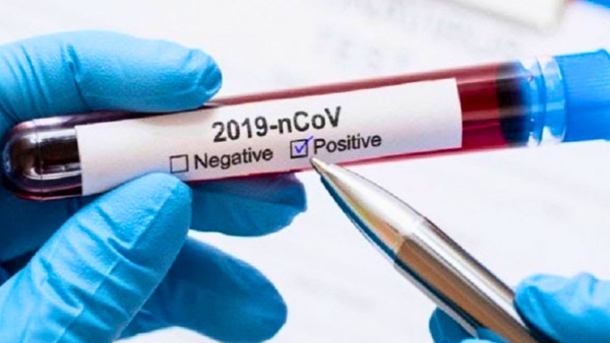 খুলনায় ২ নারীর শরীরে করোনা শনাক্ত