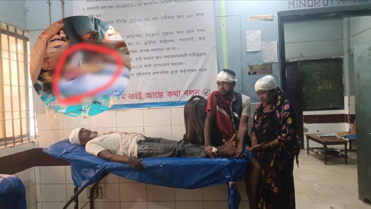 ছেলের কোপে বাবার হাত বিচ্ছিন্ন, সরকারি পুকুর নিয়ে রক্তাক্ত সংঘর্ষ