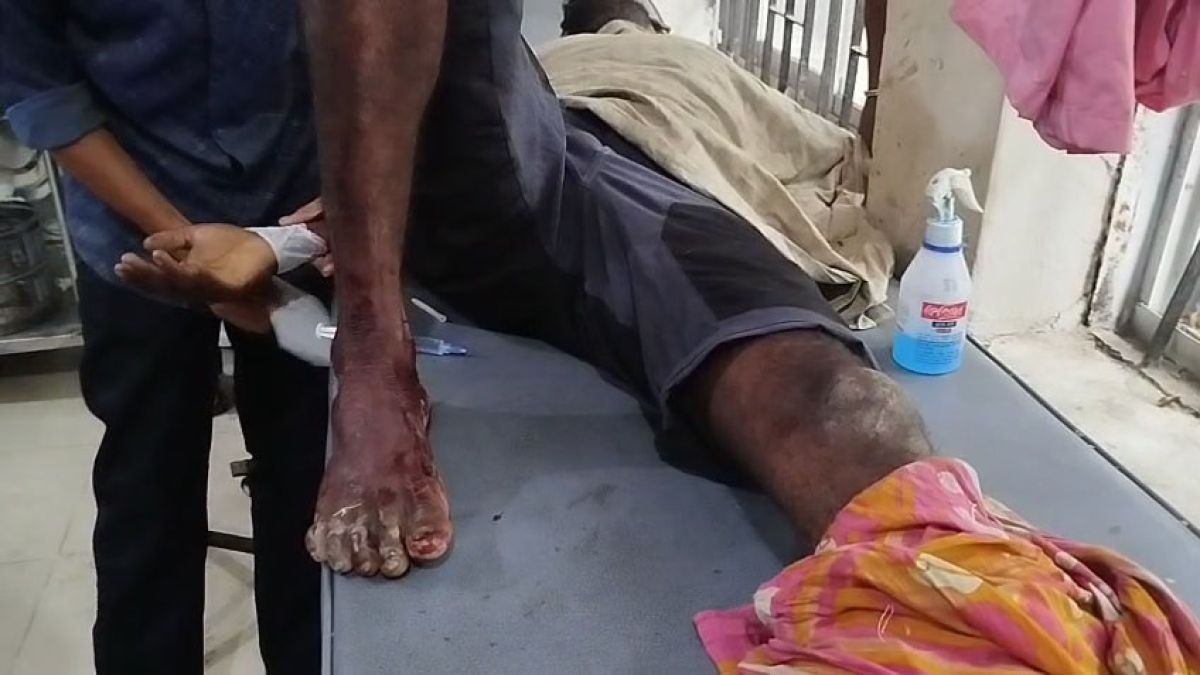 নাইক্ষ্যংছড়ি সীমান্তে ফের মাইন বিস্ফোরণ