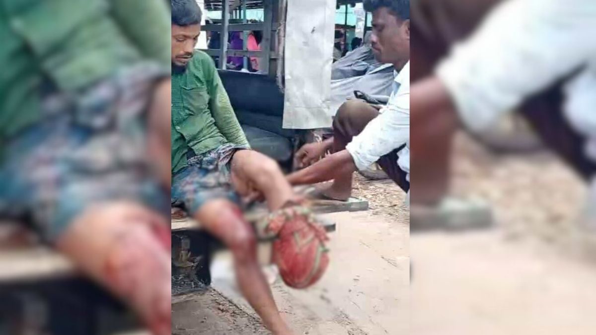 বান্দরবানে মাইন বিষ্ফোরণে যুবকের পা বিচ্ছিন্ন