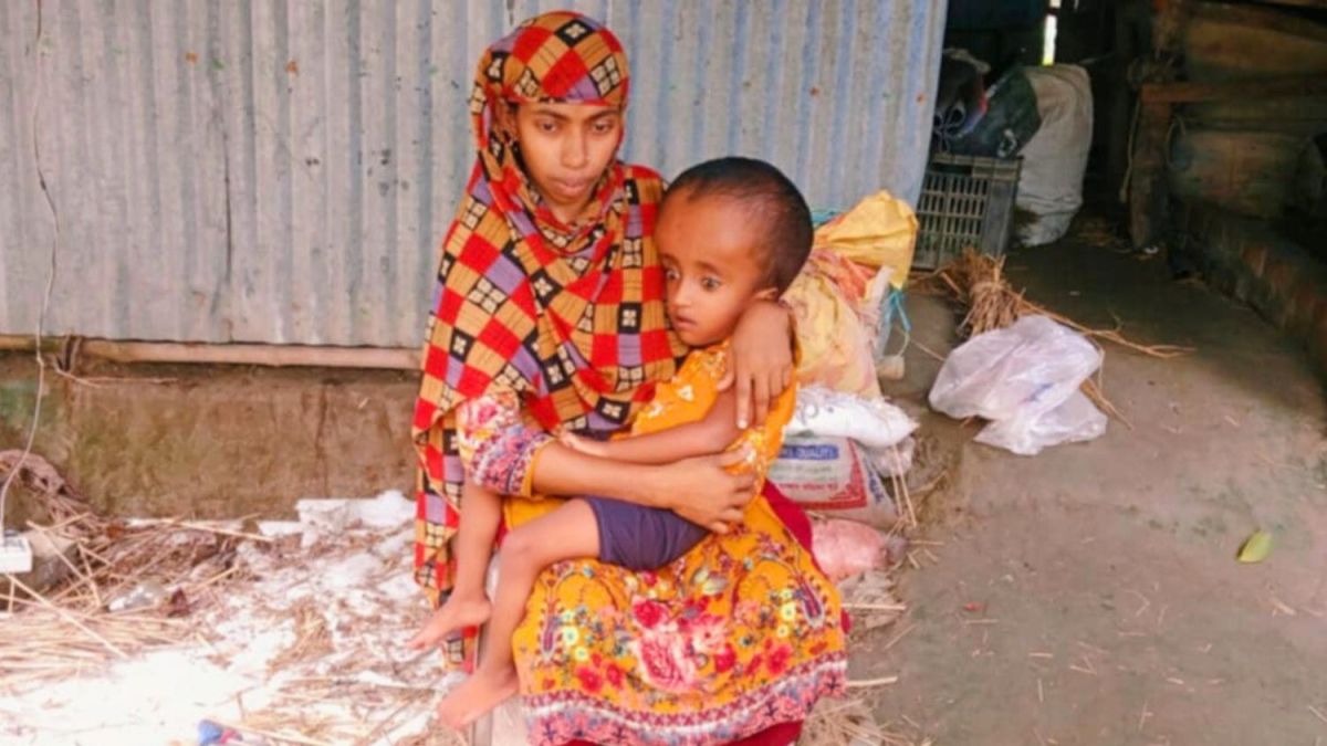 মাগুরায় বিরল রোগে আক্রান্ত শিশুকে বাঁচাতে মায়ের  আকুতি