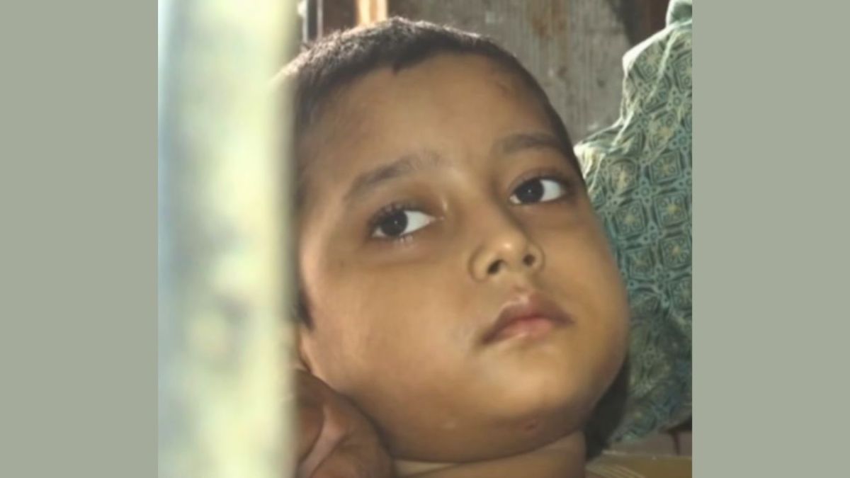 ফার্মেসিতে ভুল চিকিৎসায় হাত-পা হারানো শিশু তানভীর আর নেই