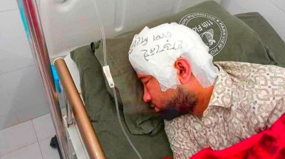 চবিতে সংঘর্ষ : মামুনের মাথায় লেখা ‘হাড় নেই, চাপ দিবেন না’