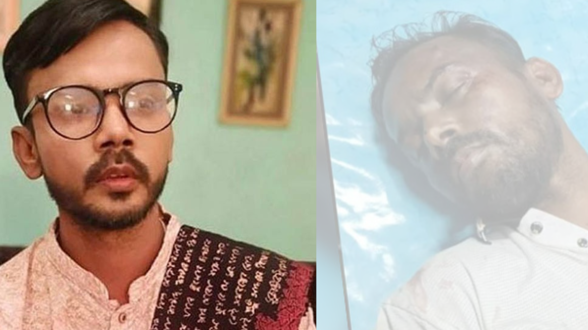 দুর্বৃত্তদের হামলায় গুরুতর আহত হিরো আলম হাসপাতালে