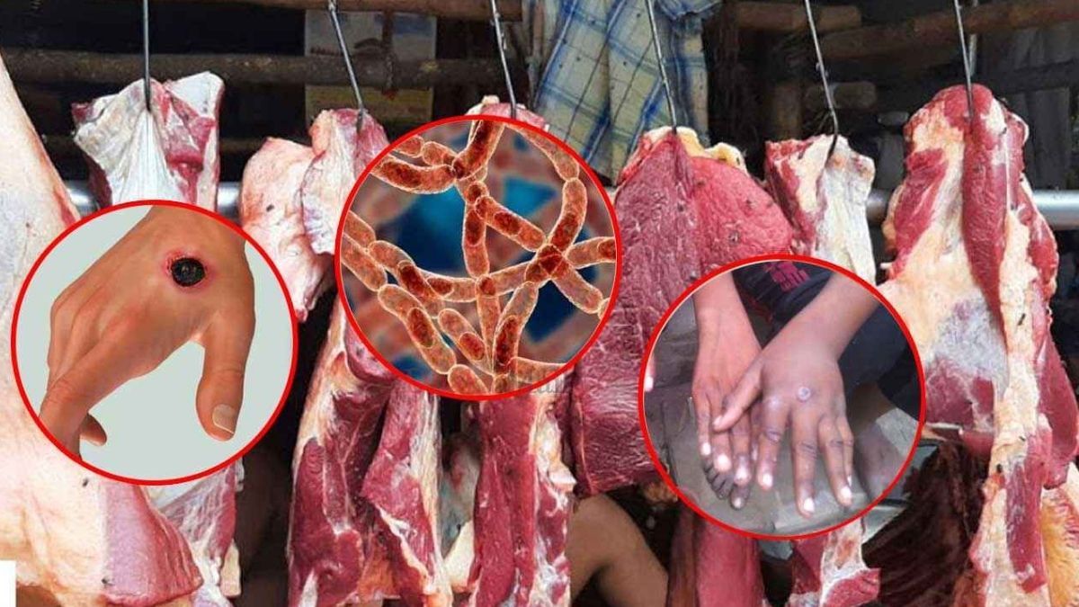 গাইবান্ধায় অ্যানথ্র্যাক্সের উপসর্গ নিয়ে নারীর মৃত্যু, আতঙ্কে এলাকাবাসী