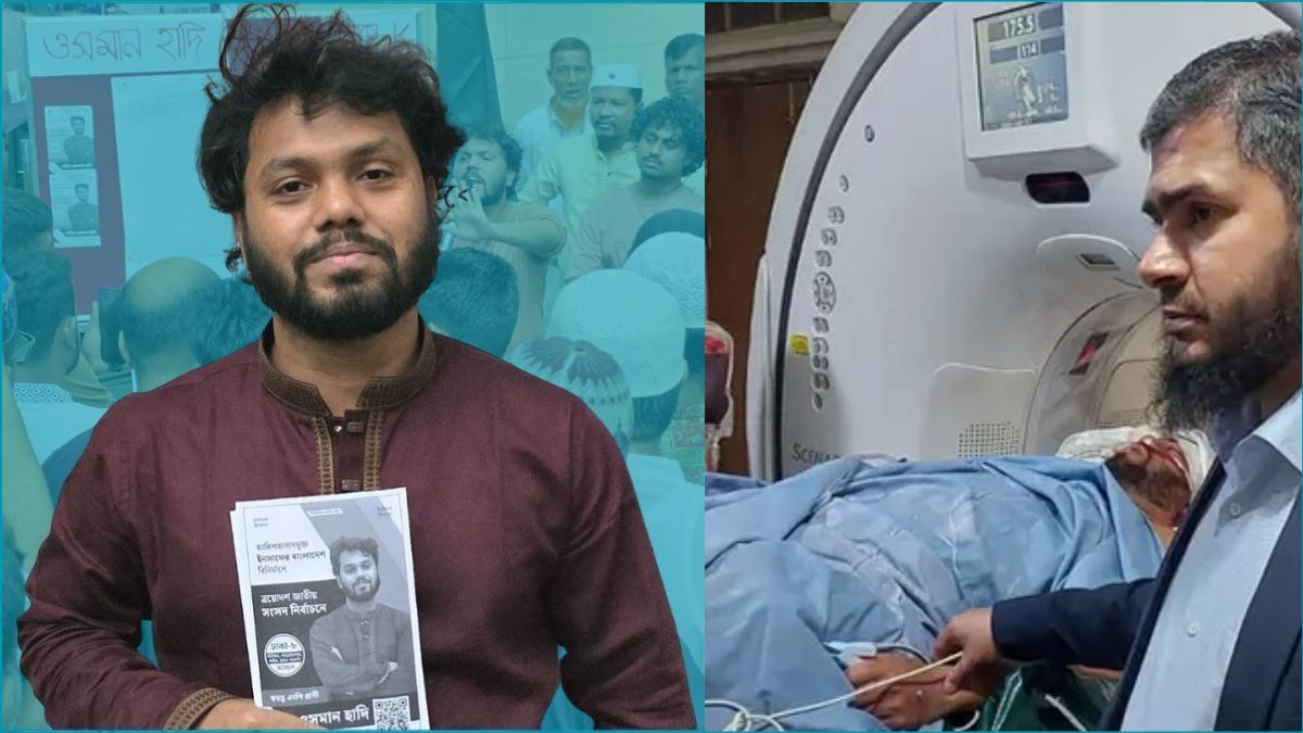 হাদিকে রাখা হয়েছে কনজারভেটিভ ম্যানেজমেন্টে