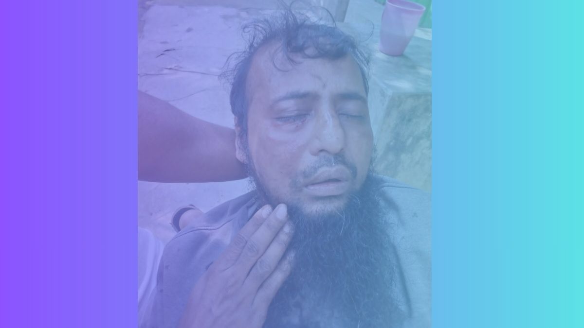 ফেনীতে জামায়াত কর্মীর দাড়ি ধরে এলোপাতাড়ি লাঠি পেটা, স্ত্রীকে হেনস্তা