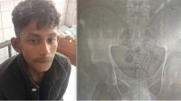 যশোরে পেটভর্তি ইয়াবাসহ যুবক আটক
