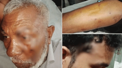 পদ্মায় টহলরত পুলিশের ওপর হামলা, ওসিসহ ৫ সদস্য গুলিবিদ্ধ