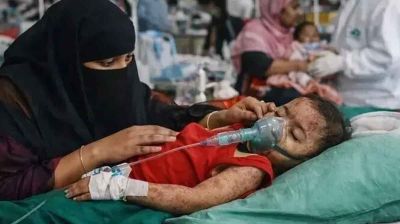 দেশে হাম ও হাম সন্দেহে শিশু মৃত্যু ২৫০ ছাড়াল