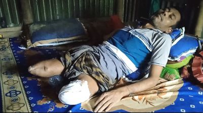 কিশোরগঞ্জে দুই পা হারিয়ে  অসহায় নুরুল ইসলাম