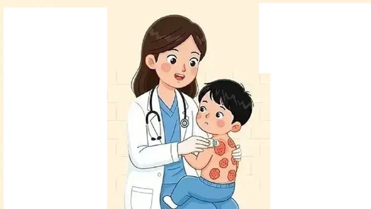 দেশে হামে শিশুমৃত্যু ৮০০ ছুঁইছুঁই