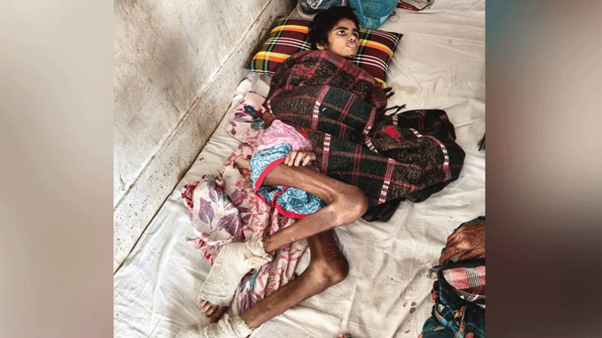 গৃহকর্মী তানিয়ার শরীরজুড়ে খুন্তির ছ্যাঁকা, পচন ধরেছে পায়ে