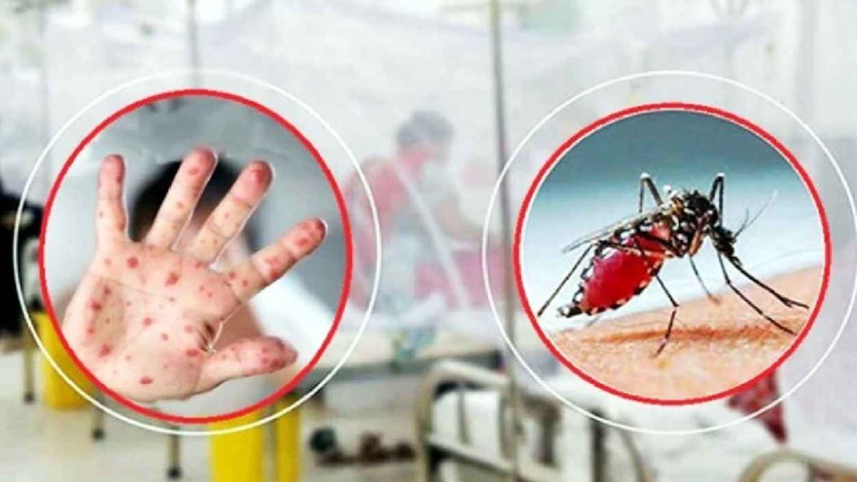 হামের উপসর্গে ৪ শিশুর মৃত্যু, ডেঙ্গুতে ৫ জনের